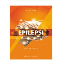 Epilepsi